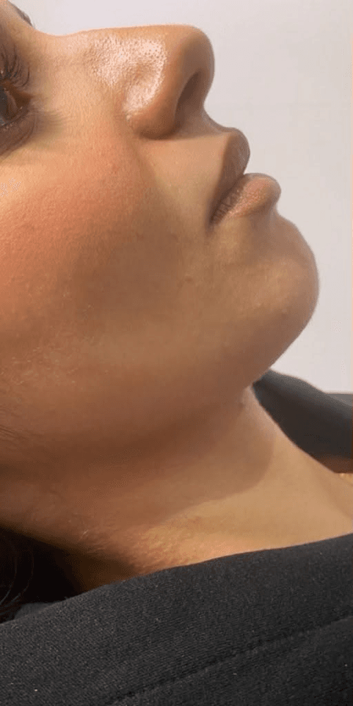 Profile Harmony — Before