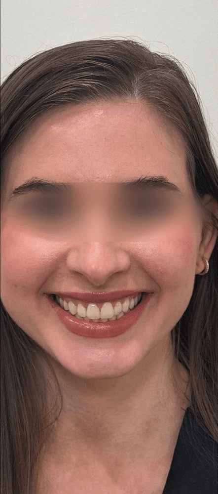 Skin Radiance — Before