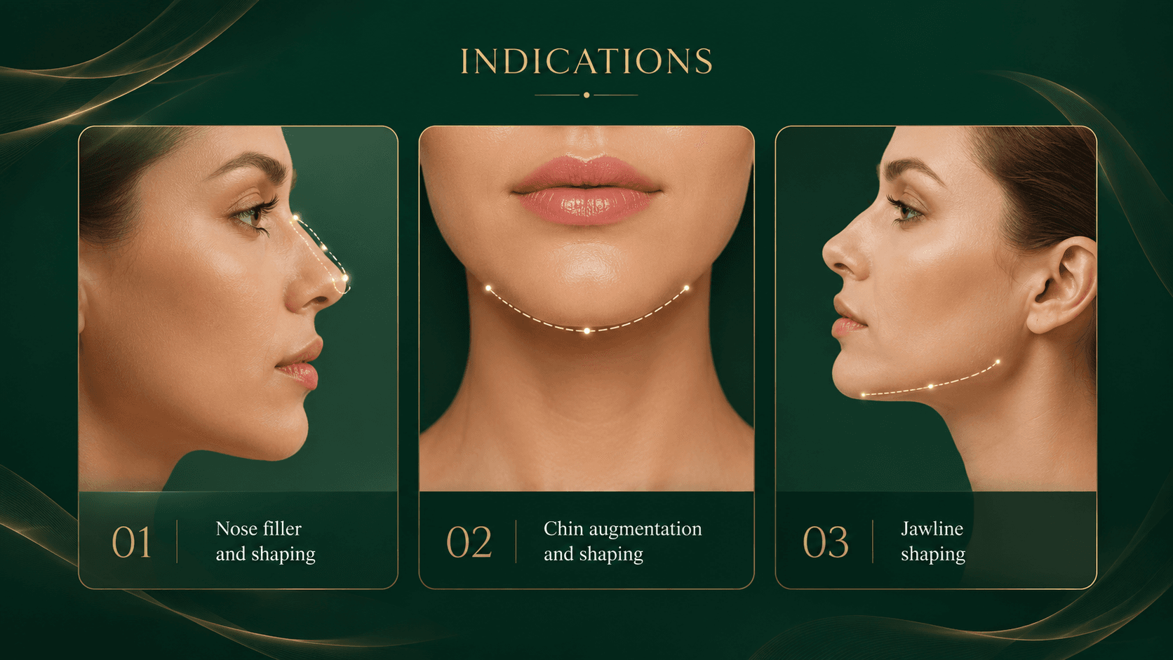 Indication: Nose filler and shaping, Chin augmentation and shaping, Jawline shaping